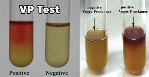 what happens to e. coli during and mr/vp test|Voges–Proskauer (VP) Test.